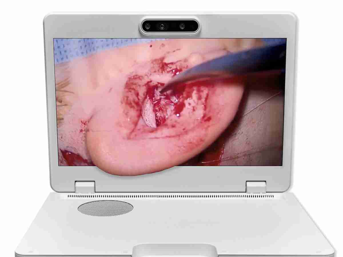 达擎之＂Heads-up 3D显微手术显示系统＂，，，，整合4K裸眼3D显示及眼球追踪系统，，，具备快速追踪人眼移动位置功能，，，减轻医师长时间维持固定姿势的负担，，让医师能有更宽广清晰的3D立体视野及更舒适的姿势来执行手术。。